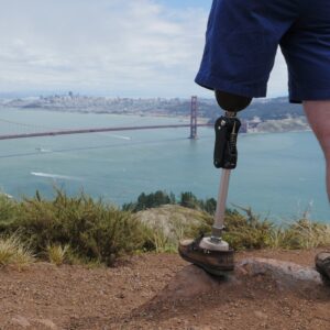 LegWorks: Bold movement breaking down barriers to mobility